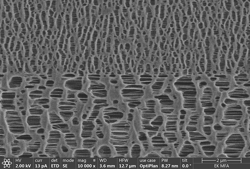 Cross-sectional scanning electron microscopic image of an accumulator separator film